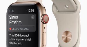 98 százalékos pontossággal mutatja ki a pitvarfibrillációt az Apple Watch S4