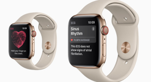 Hamarosan a stroke előjeleit is kimutathatja az Apple Watch